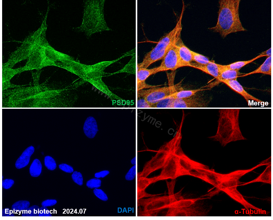 Anti-PSD95 Rabbit mAb [21E45F92]