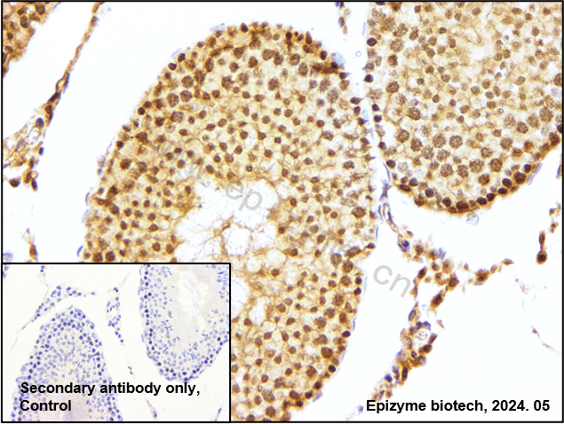 Anti-Cyclin E1 Rabbit mAb [56E11C04]