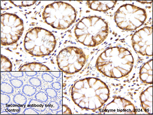 Anti-Cyclin E1 Rabbit mAb [56E11C04]