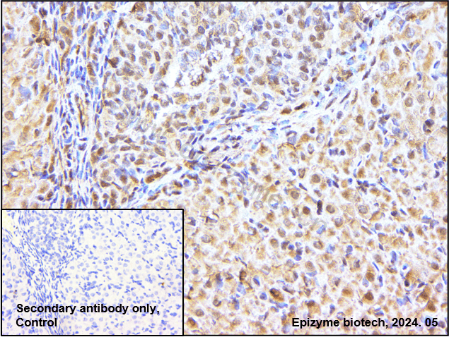 Anti-Cyclin E1 Rabbit mAb [56E11C04]