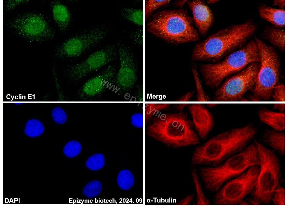 Anti-Cyclin E1 Rabbit mAb [56E11C04]
