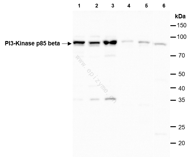Anti-PI3-Kinase p85 beta Rabbit mAb [31C49E09]