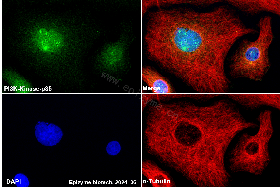 Anti-PI3-Kinase p85 beta Rabbit mAb [31C49E09]