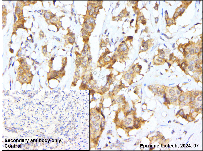 Anti-PI3-Kinase p85 beta Rabbit mAb [31C49E09]