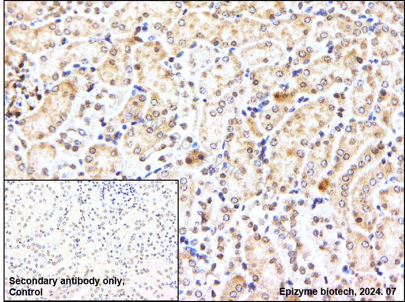 Anti-PI3-Kinase p85 beta Rabbit mAb [31C49E09]