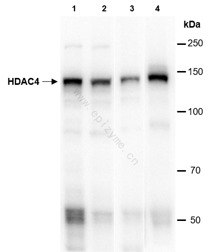Anti-HDAC4 Rabbit mAb [53C01M23]