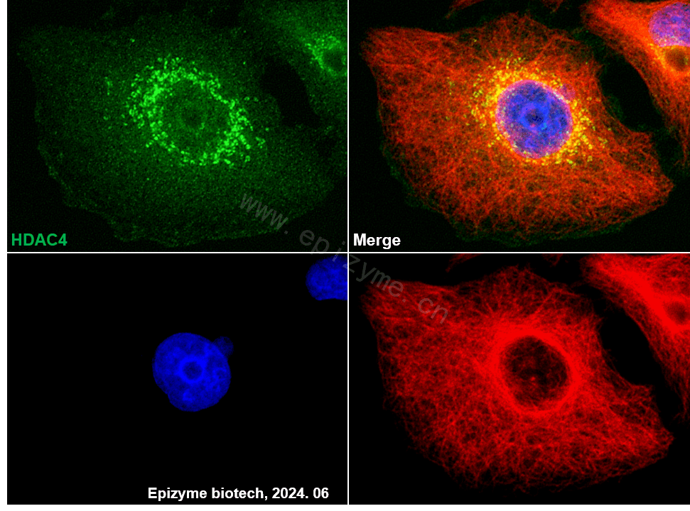 Anti-HDAC4 Rabbit mAb [53C01M23]