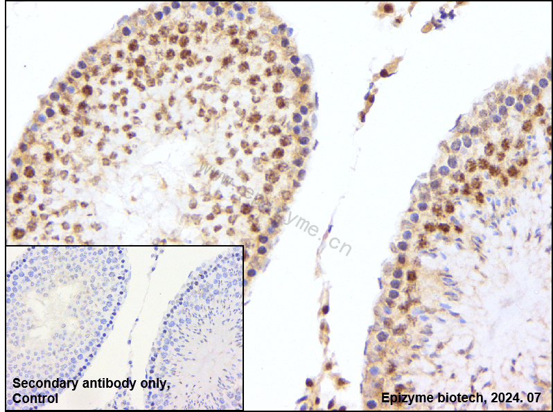 Anti-HDAC4 Rabbit mAb [53C01M23]
