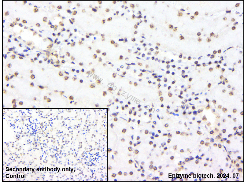 Anti-HDAC4 Rabbit mAb [53C01M23]