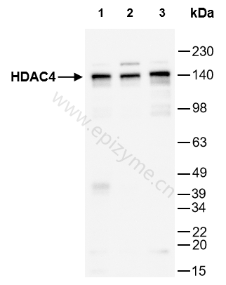 Anti-HDAC4 Rabbit mAb [53C01M23]