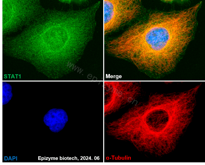 Anti-STAT1 Rabbit mAb [26C92E46]