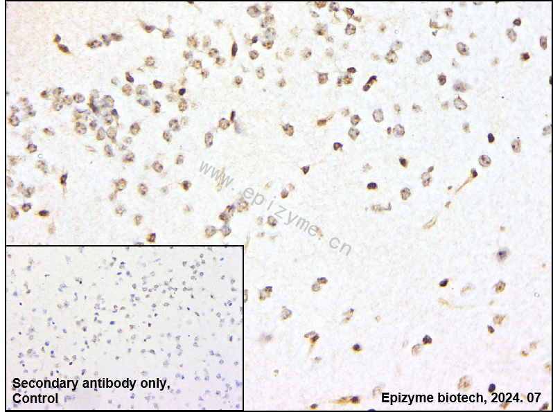 Anti-STAT1 Rabbit mAb [26C92E46]