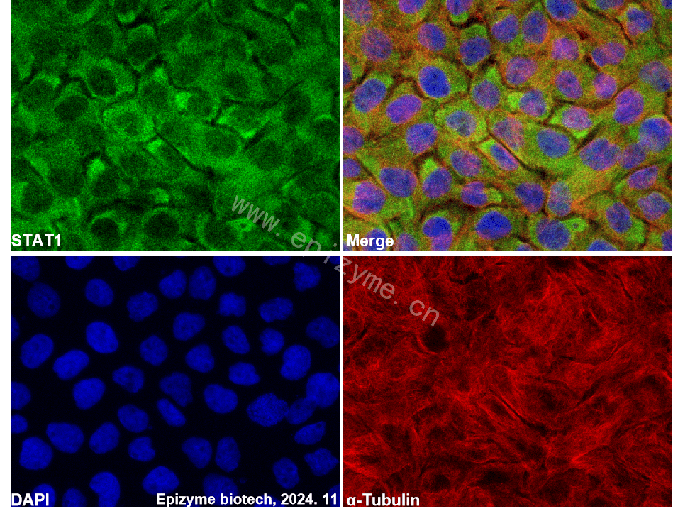 Anti-STAT1 Rabbit mAb [26C92E46]