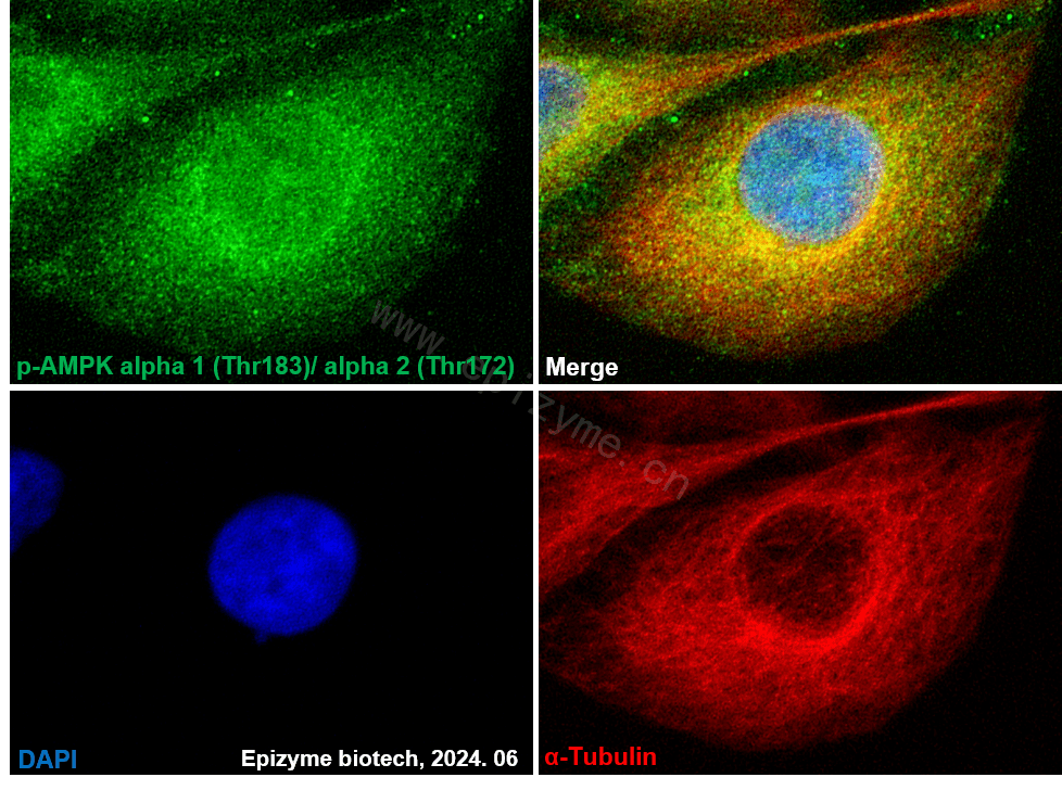 Anti-Phospho-AMPK alpha 1 (Thr183)/AMPK alpha 2 (Thr172) Rabbit mAb [48F92M22]