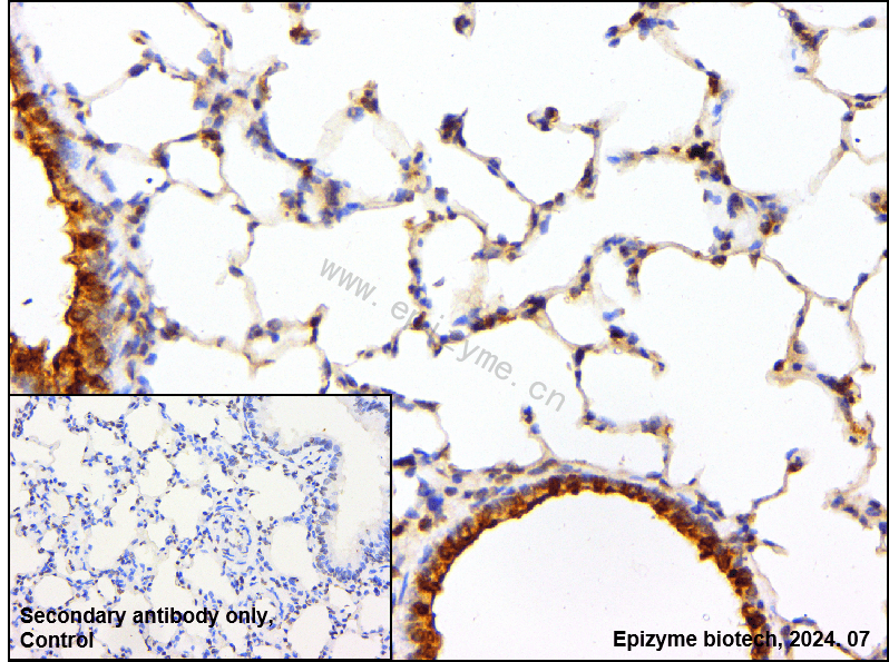 Anti-Phospho-AMPK alpha 1 (Thr183)/AMPK alpha 2 (Thr172) Rabbit mAb [48F92M22]