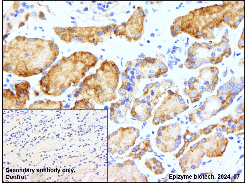 Anti-Phospho-AMPK alpha 1 (Thr183)/AMPK alpha 2 (Thr172) Rabbit mAb [48F92M22]