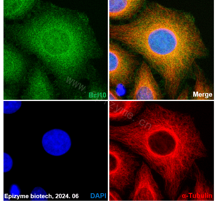 Anti-Bcl10 Rabbit mAb [27C91F46]