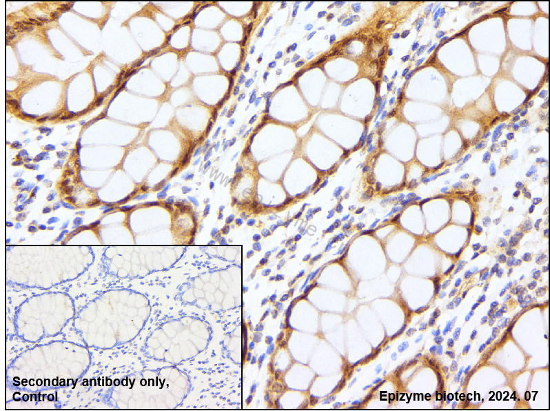 Anti-Bcl10 Rabbit mAb [27C91F46]