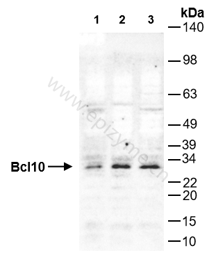 Anti-Bcl10 Rabbit mAb [27C91F46]