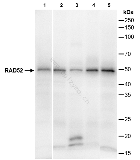 Anti-RAD52 Rabbit mAb [37F33M08]