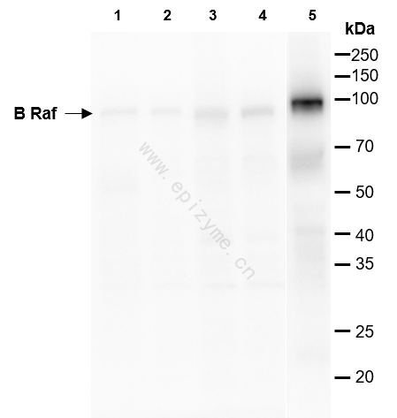 Anti-BRAF Rabbit mAb [29M71E67]