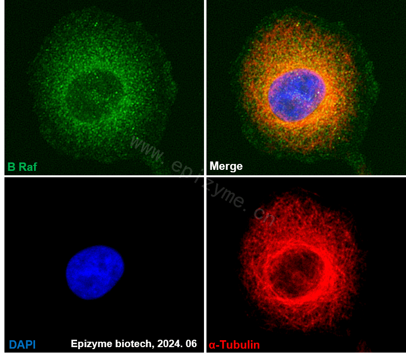 Anti-BRAF Rabbit mAb [29M71E67]