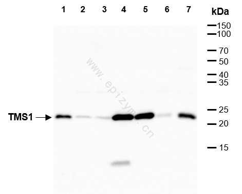 Anti-TMS1 Rabbit mAb [84C38F92]