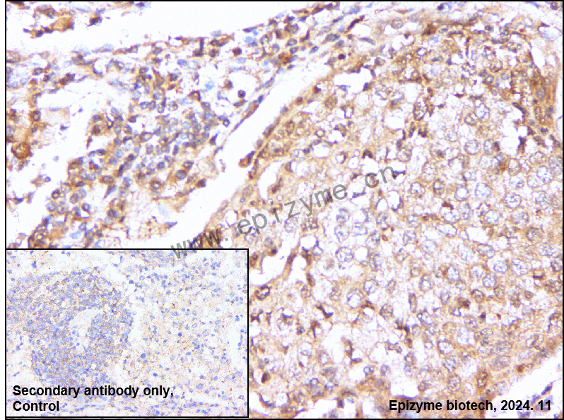 Anti-TMS1 Rabbit mAb [84C38F92]