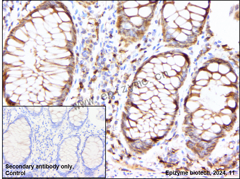 Anti-TMS1 Rabbit mAb [84C38F92]