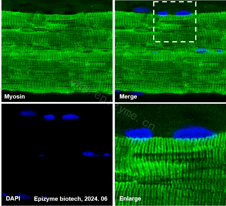 Anti-Myosin light chain 3 Rabbit mAb [48M01D83]