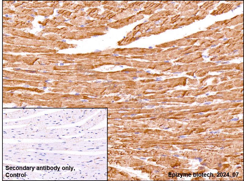 Anti-Myosin light chain 3 Rabbit mAb [48M01D83]
