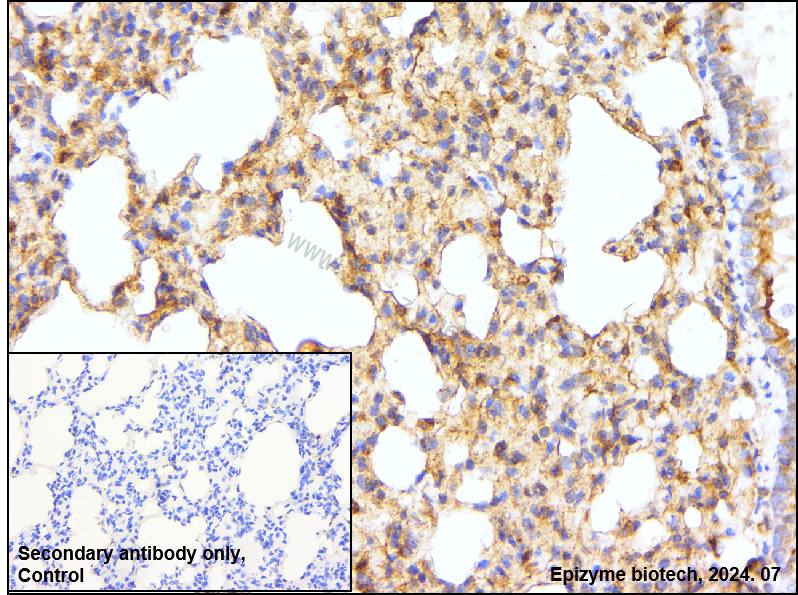 Anti-Flotillin 2 Rabbit mAb [90E21L43]