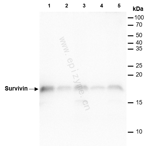 Anti-Survivin Rabbit mAb [62H08D19]