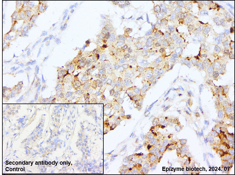 Anti-Survivin Rabbit mAb [62H08D19]
