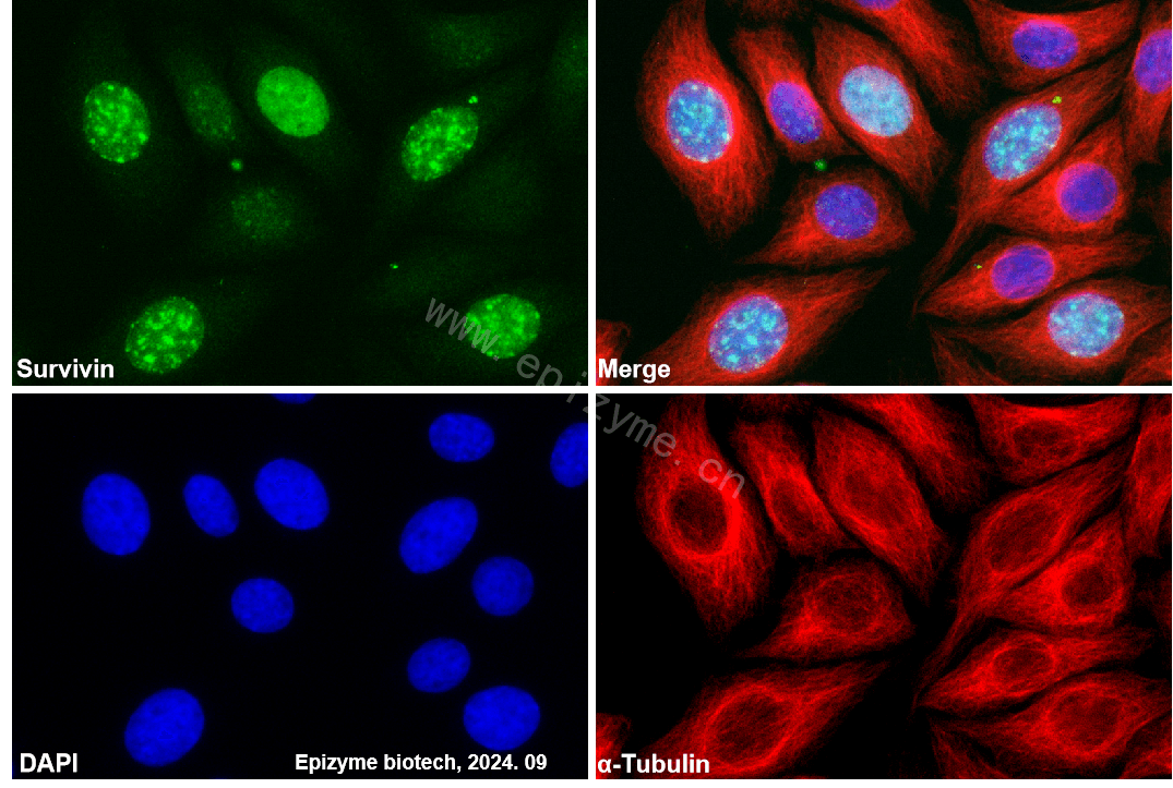 Anti-Survivin Rabbit mAb [62H08D19]