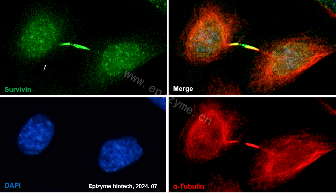 Anti-Survivin Rabbit mAb [62H08D19]