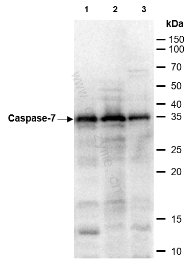 Anti-Caspase 7 Rabbit mAb [10M50L23]