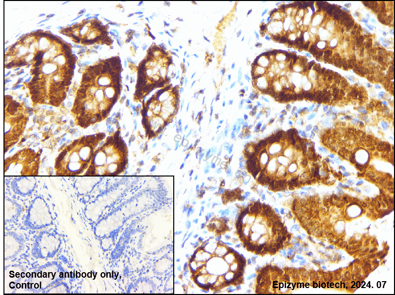 Anti-Caspase 7 Rabbit mAb [10M50L23]