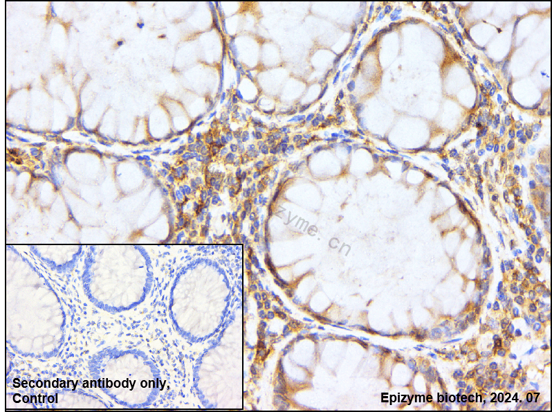 Anti-Caspase 7 Rabbit mAb [10M50L23]