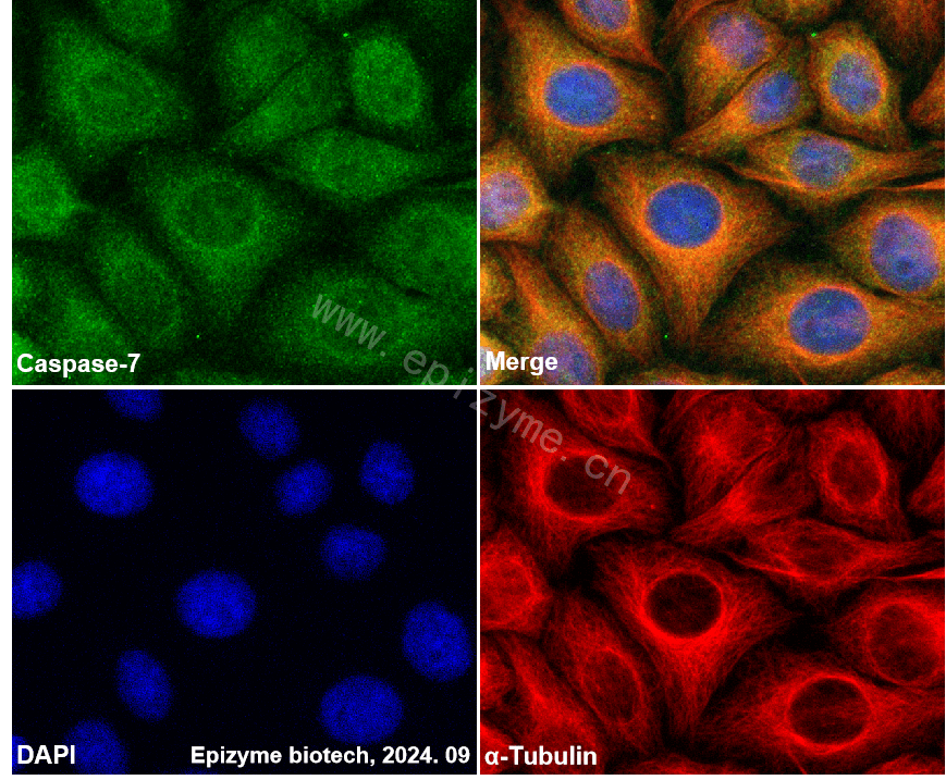 Anti-Caspase 7 Rabbit mAb [10M50L23]