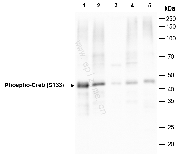 Anti-Phospho-CREB (Ser133) Rabbit mAb [83G12F48]