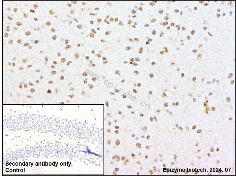 Anti-Phospho-CREB (Ser133) Rabbit mAb [83G12F48]