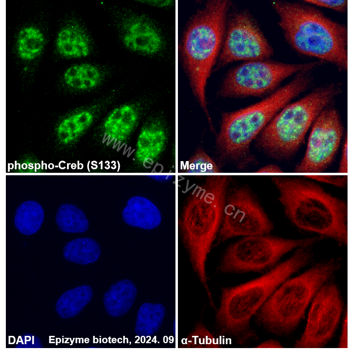 Anti-Phospho-CREB (Ser133) Rabbit mAb [83G12F48]