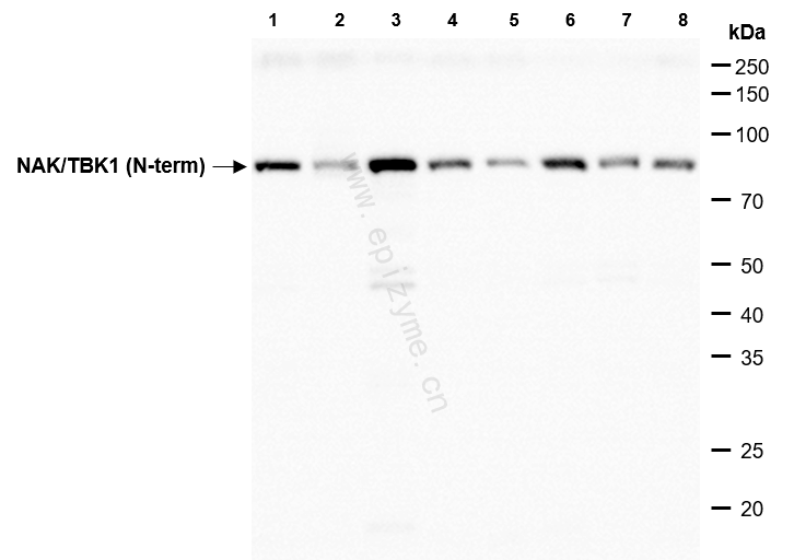 Anti-TBK1 Rabbit mAb [35C09K73]