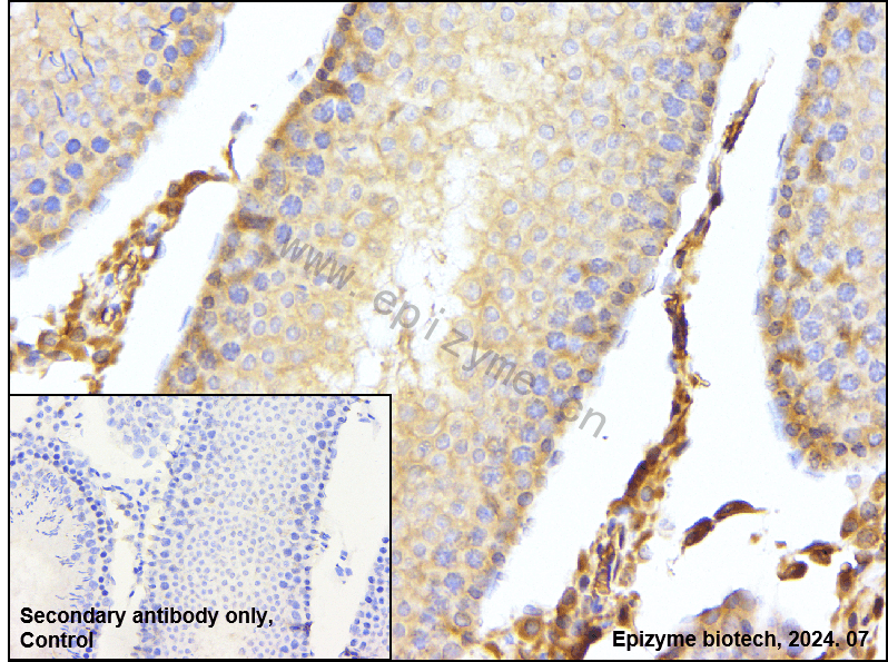 Anti-TBK1 Rabbit mAb [35C09K73]