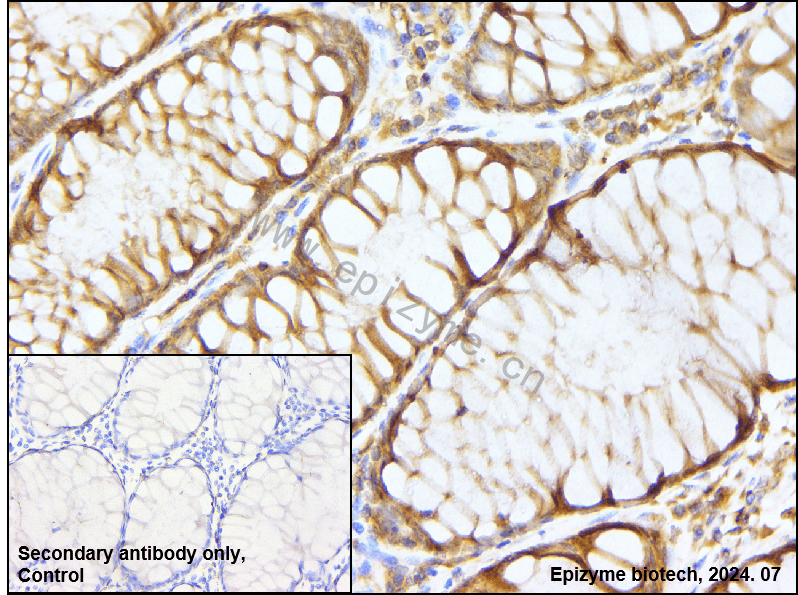 Anti-TBK1 Rabbit mAb [35C09K73]