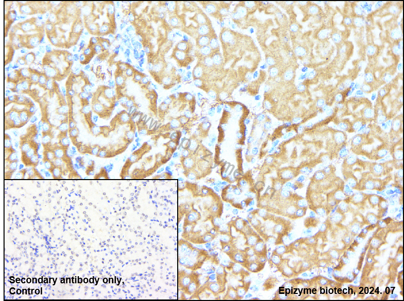 Anti-TBK1 Rabbit mAb [35C09K73]