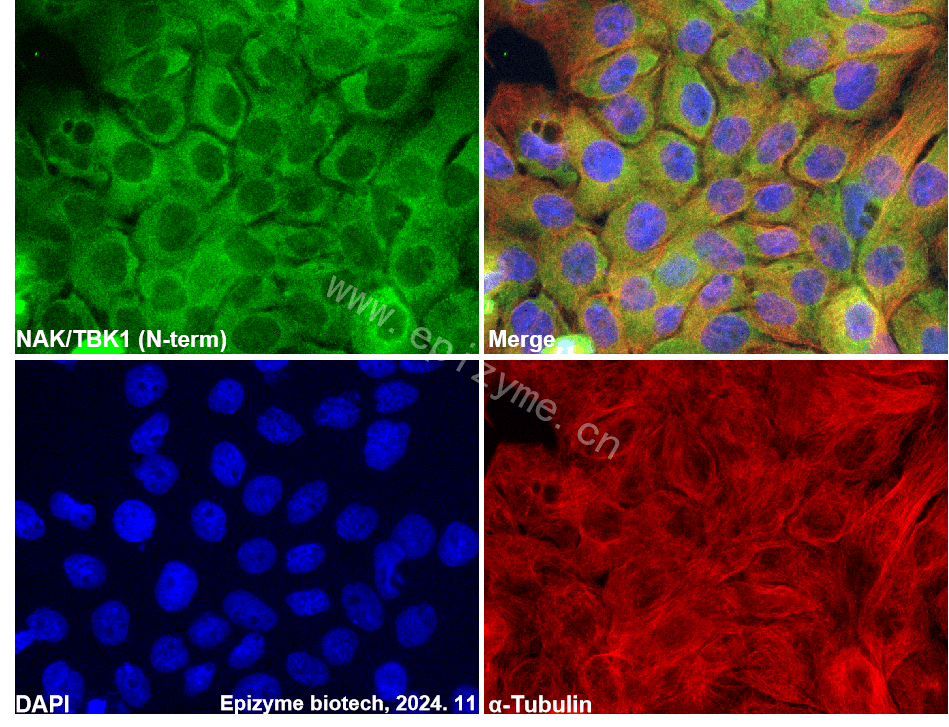 Anti-TBK1 Rabbit mAb [35C09K73]