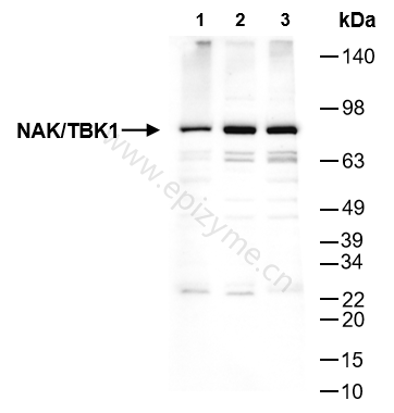 Anti-TBK1 Rabbit mAb [35C09K73]