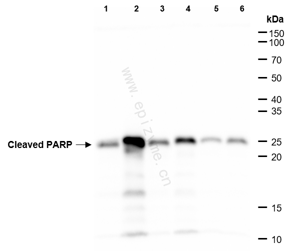 Anti-Cleaved-PARP1 Rabbit mAb [72B40L26]